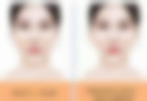 身体肥胖抽脂靠谱吗