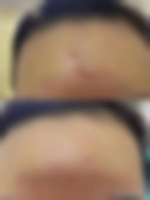 深圳星妍整形医院营业时间：方便你的美丽之旅