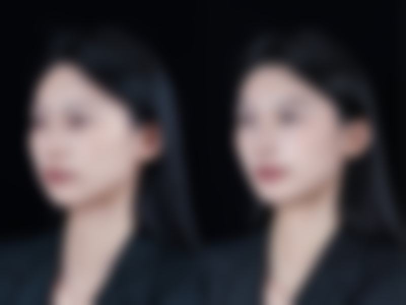 韩国Orange橙色整形外科仪器设备：精良科技助力美丽