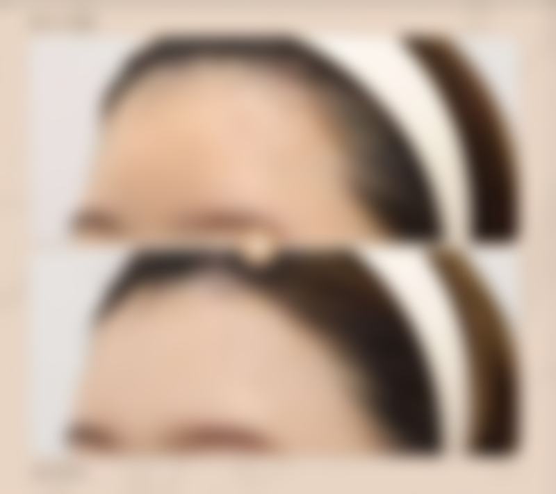 天津爱天使医疗美容诊所擅长项目