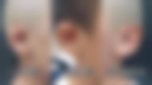 李加敏医生擅长项目