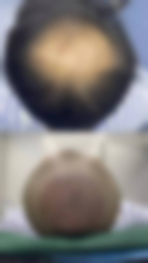 河南禾美毛囊移植中 心医生名单