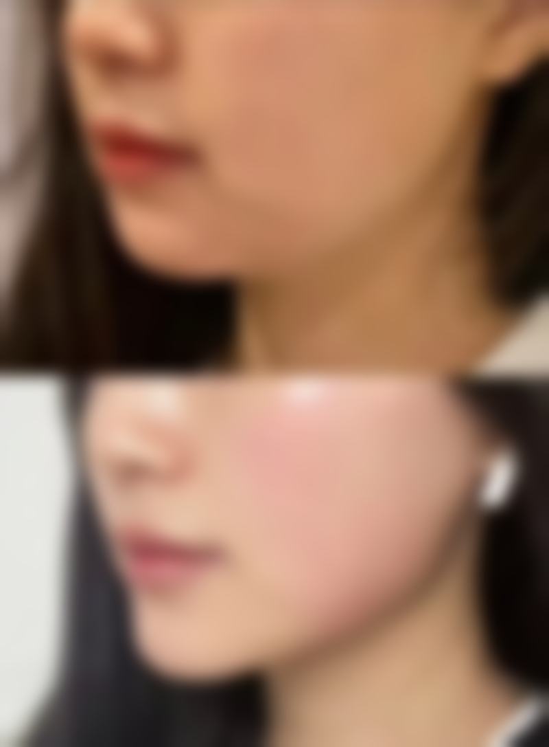 郑州华 山医院医生名单：都有谁？