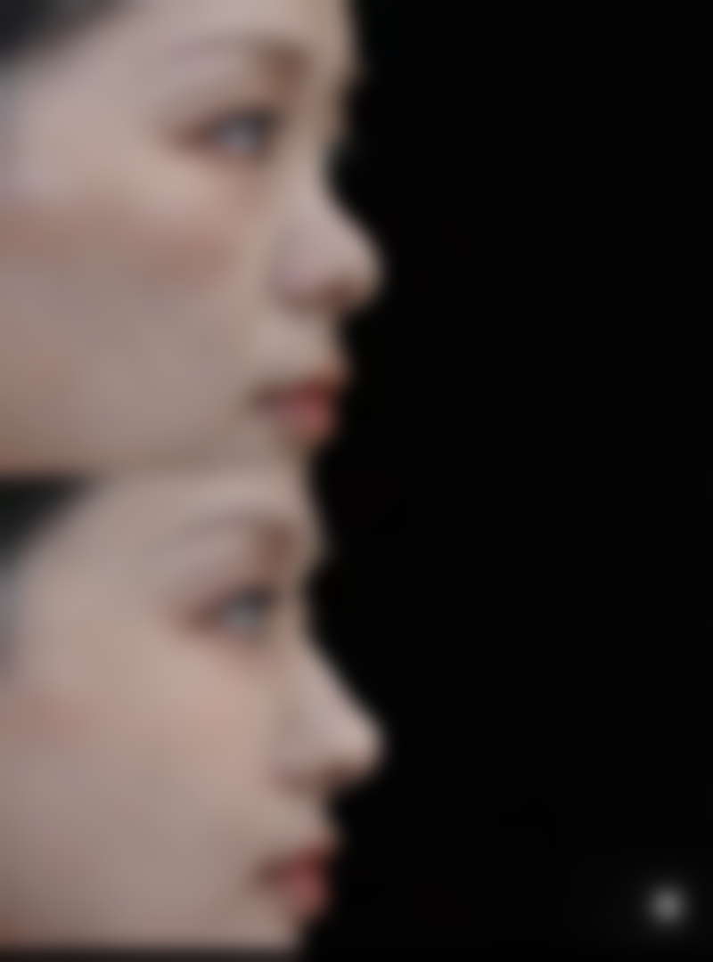 遂宁熙美医疗美容门诊部擅长项目