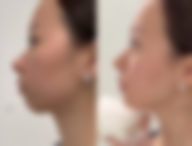 使用眼霜淡化眼袋要注意什么