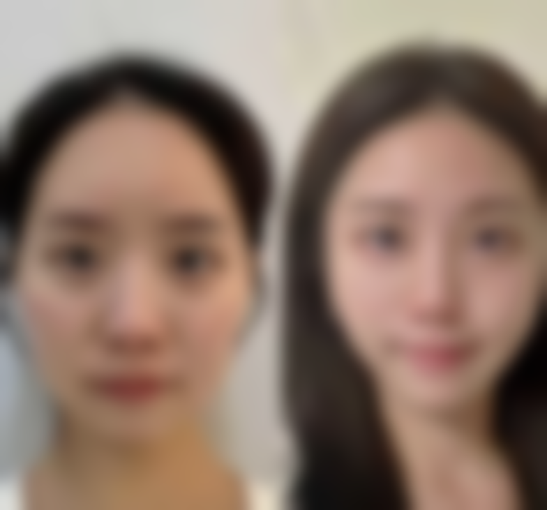 金式伦医生技术特点