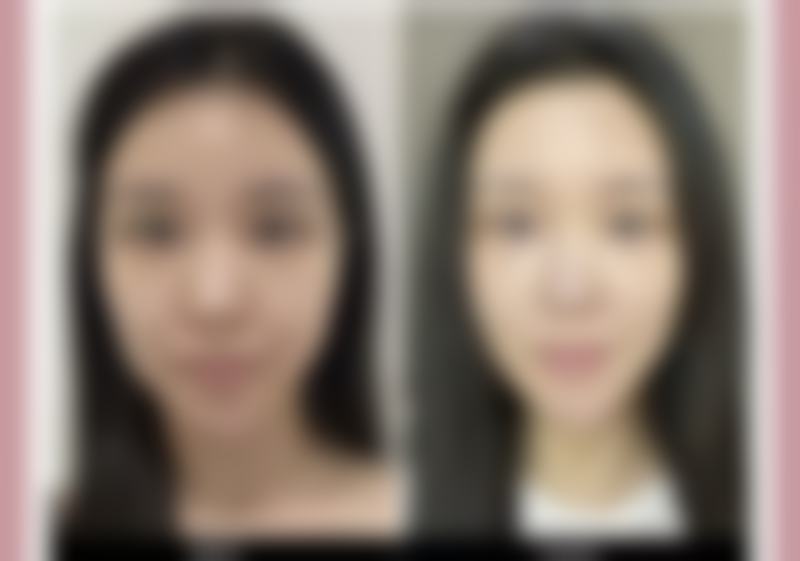 正规眼霜能淡化眼袋是真的吗