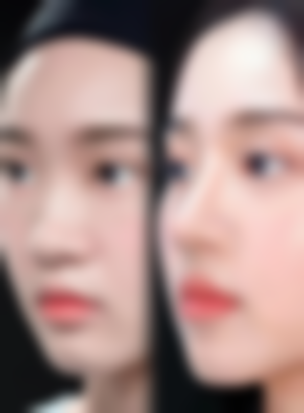 深圳仙紫医疗美容诊所真实实例