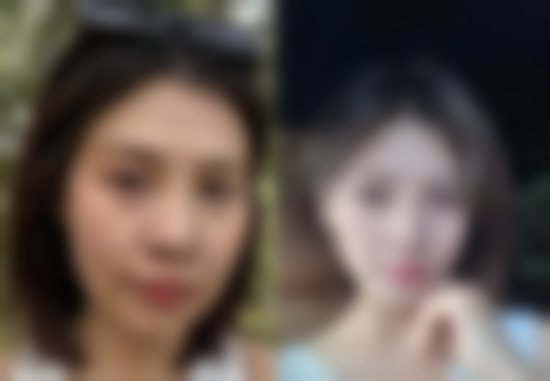 金式伦医生真实实例