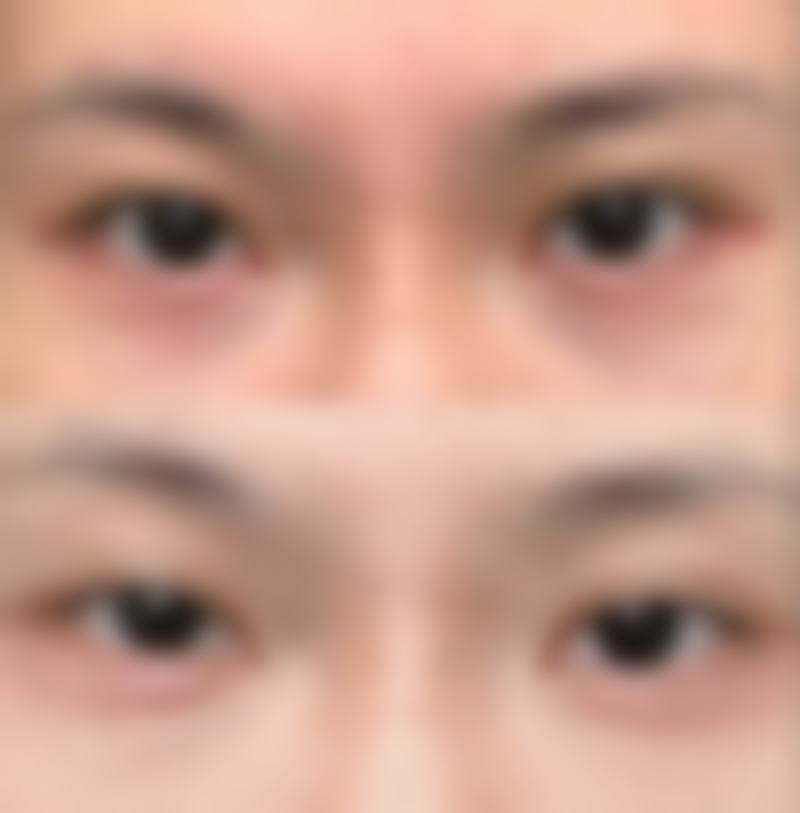 郑州华 山医院价格表：贵不贵？