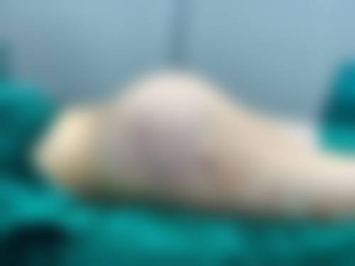 黄石修复医学美容门诊部仪器设备