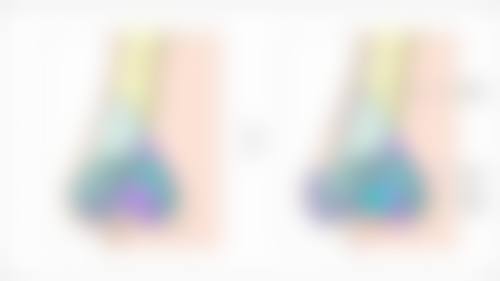 割双眼皮后的注意事项有哪些？术后一周内伤口别沾水、饮食忌辛辣，3个月内少化眼妆助恢复！ 