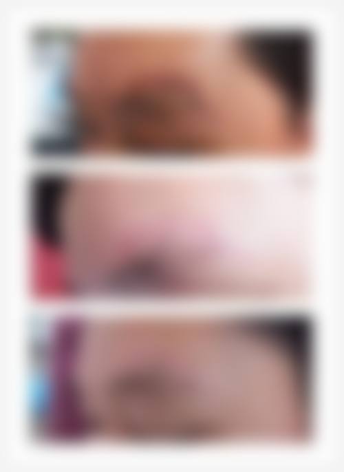 开封艺美医学美容门诊部营业时间：随时为美待命