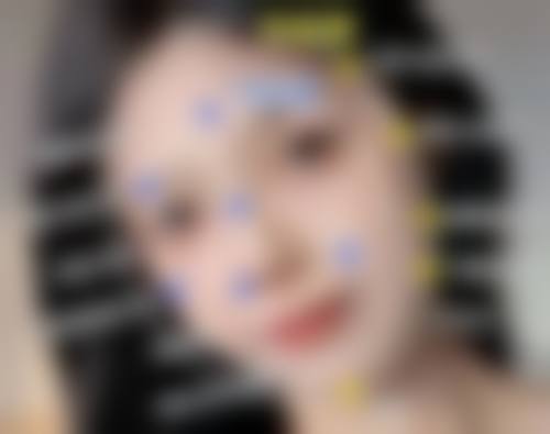 进口瘦脸针维持时间和注射剂量有关吗