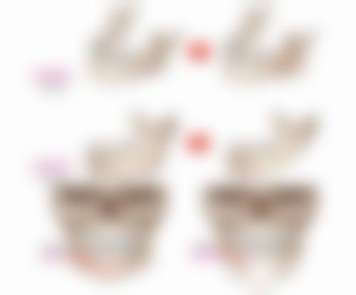 袁相斌医生技术特点