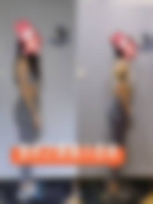 南昌悦她婕熹卡医疗美容门诊部真实实例