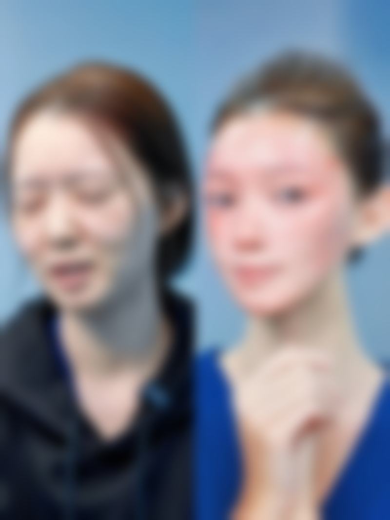 崔贤敏（Choi Hyun - min）院长真实实例