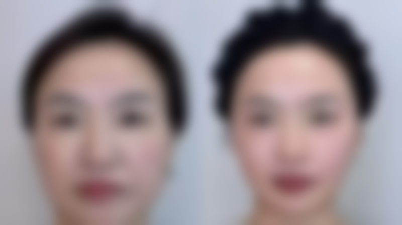 东莞紫芯整形医院预约挂号方式：便捷开启美丽之旅