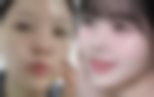 老人眼袋发紫该怎么应对