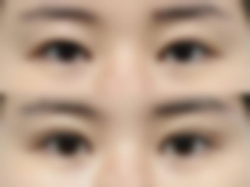 长春奥莱依医疗美容门诊部真实实例