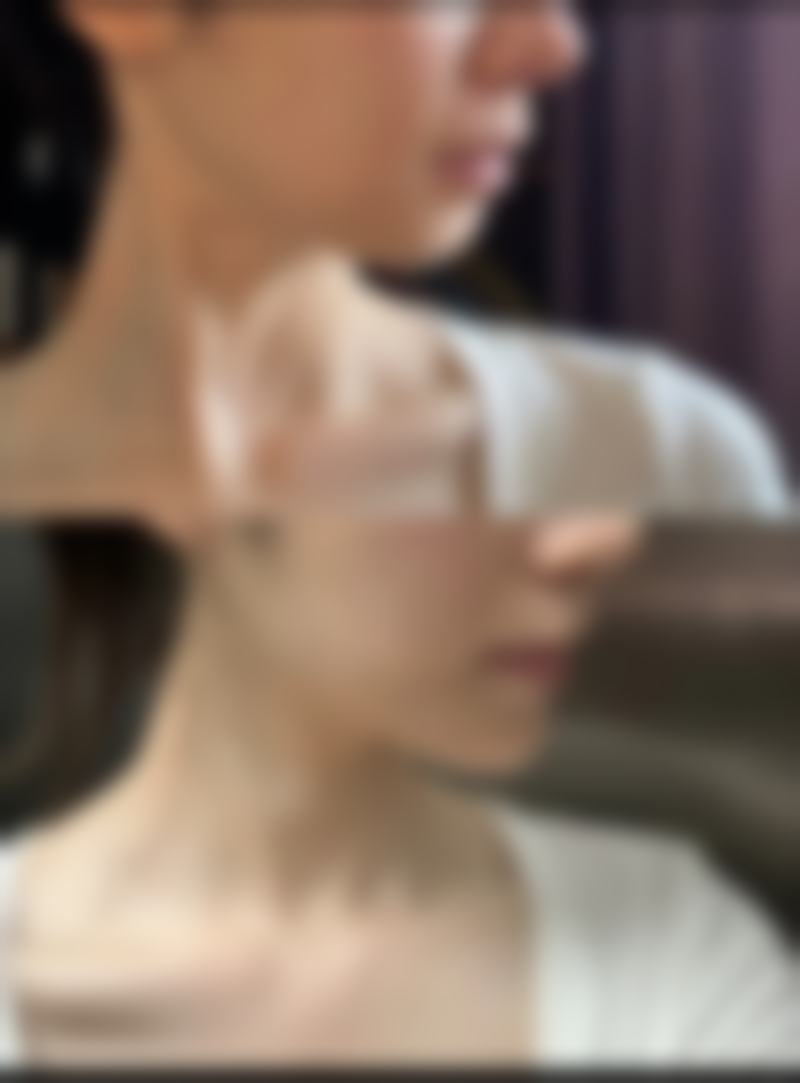 东莞紫芯整形医院口碑怎么样：顾客评价见证实力