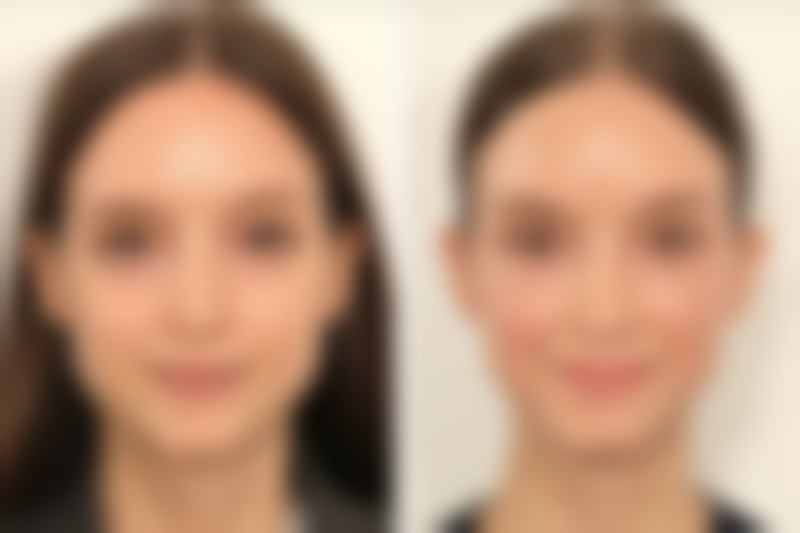 驻马店颜咖医疗美容门诊部仪器设备