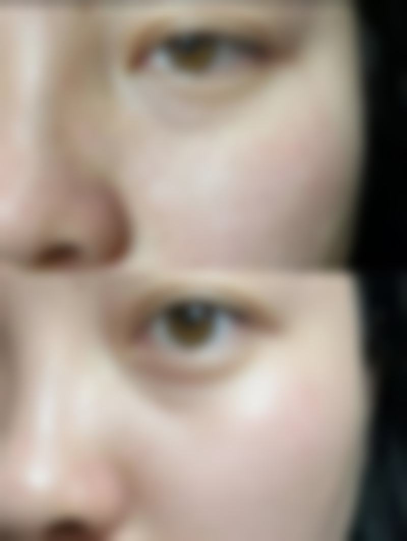 上海德琳医疗美容医院男性私密中 心包皮环切术收费靠谱吗