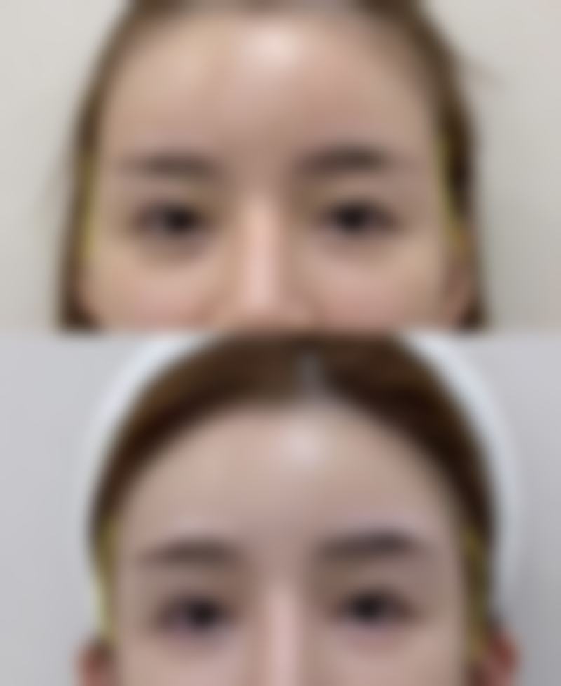 朱建凤医生擅长项目：解锁美丽密码