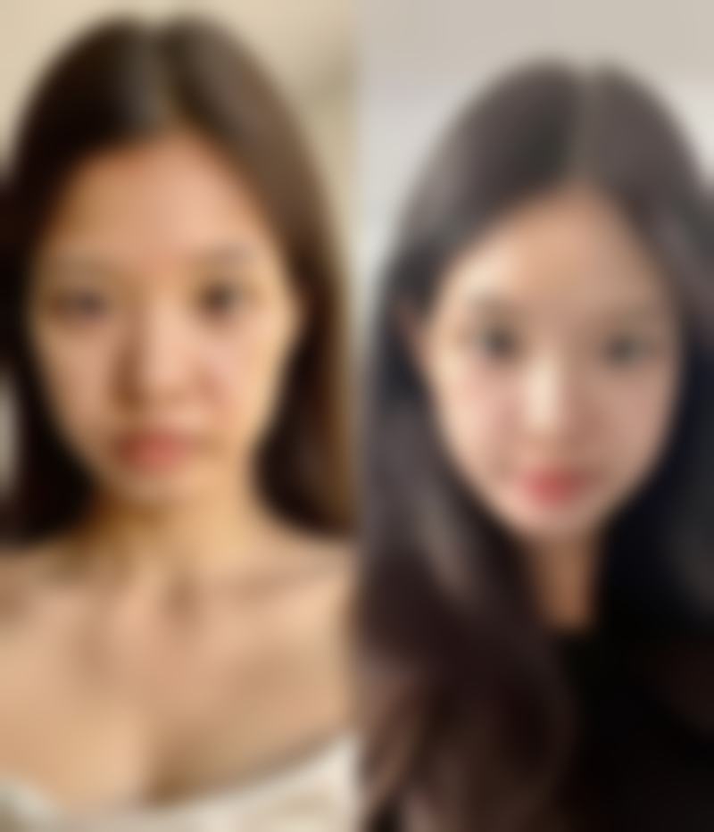 医美界刘丽敏医生口碑评价