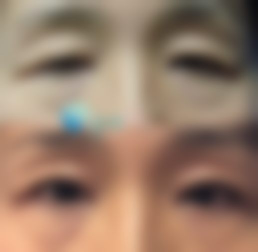 韩国纯真整形外科医院口碑怎么样