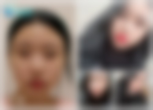 韩国纯真整形外科医院价格表