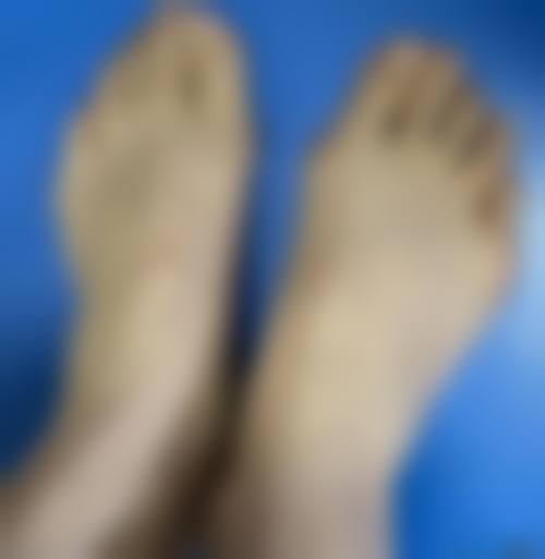 长沙芮斐医疗美容诊所真实实例