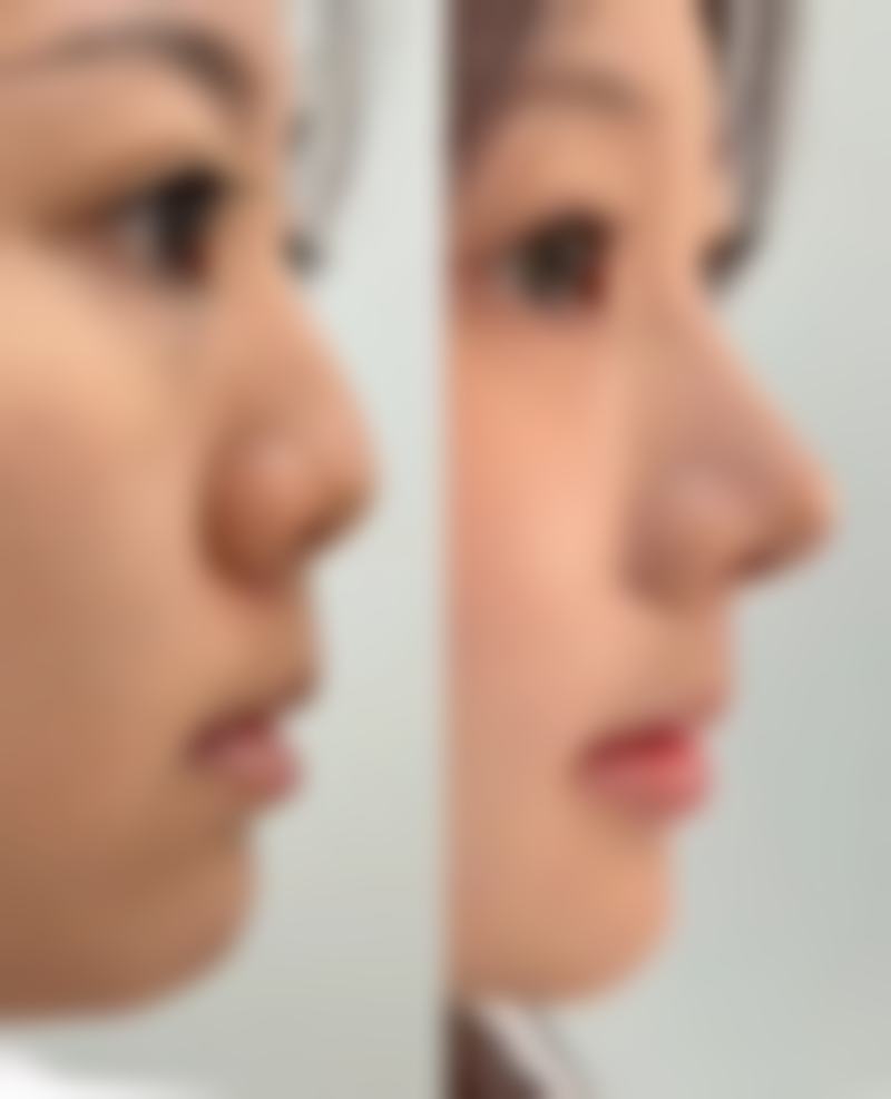 AMOND整形外科价格表：合理收费，物超所值