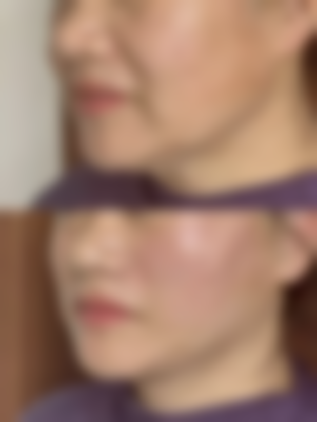 广州蒂伊医疗美容整形医院口碑怎么样