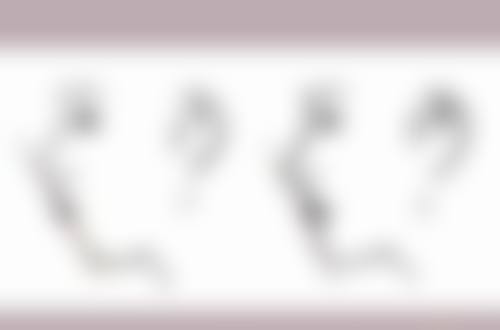 玻尿酸填充泪沟调理眼袋发黑适合吗