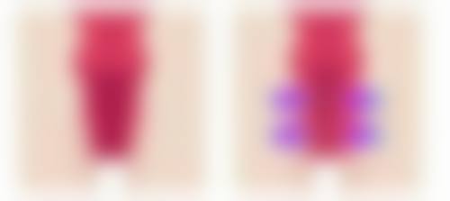 白毒瘦脸针安心吗