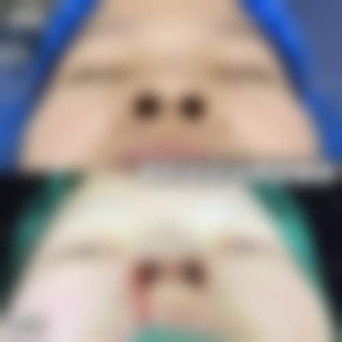 绵阳圣蓝领美医疗美容门诊部擅长项目