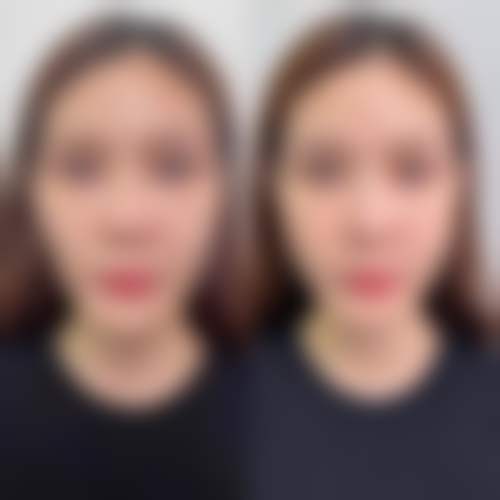 青岛初凝医疗美容诊所口碑怎么样