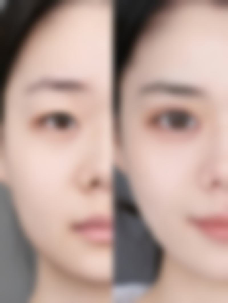 顾淑萍医生技术特点