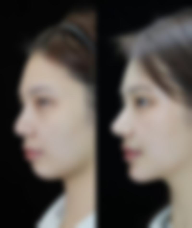 沈阳创美荟医疗美容真实实例：变得更美奇迹在这里上演