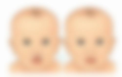 妙桃做隆胸效果怎么样？自然饱满、持久塑形，助你拥有傲人双峰，开启自信魅力人生！ 