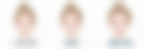 如何预防隆鼻几年后感染