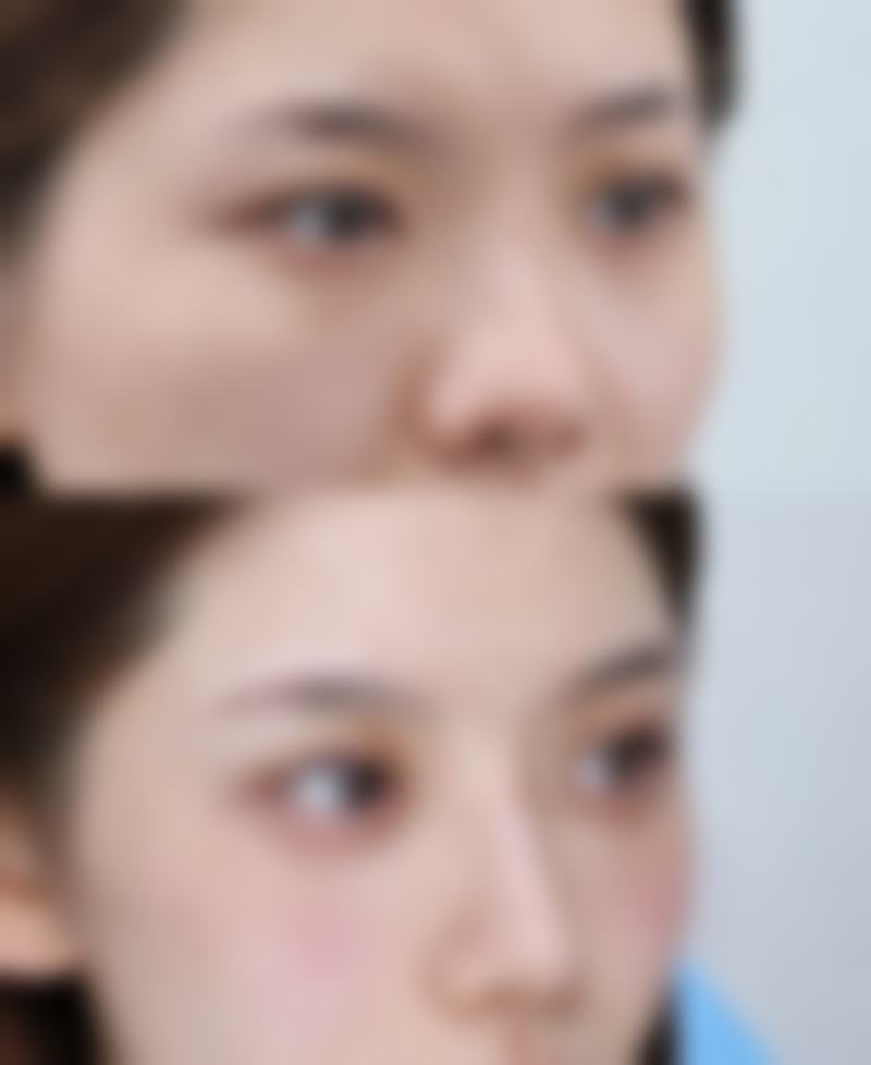 芦荟修复疤痕靠谱吗