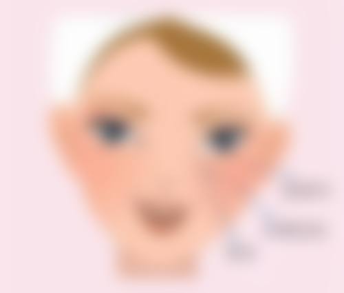 微晶磨皮去除疤痕黑色成效怎么样
