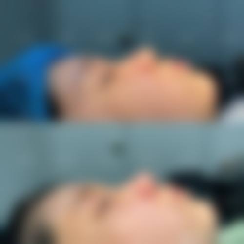 杭州婉美医疗美容整形医院真实实例