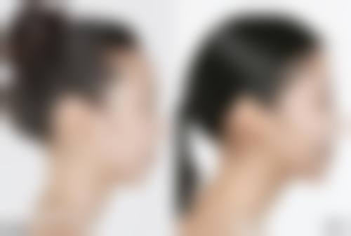 孝感仁爱医院美容整形中 心价格表