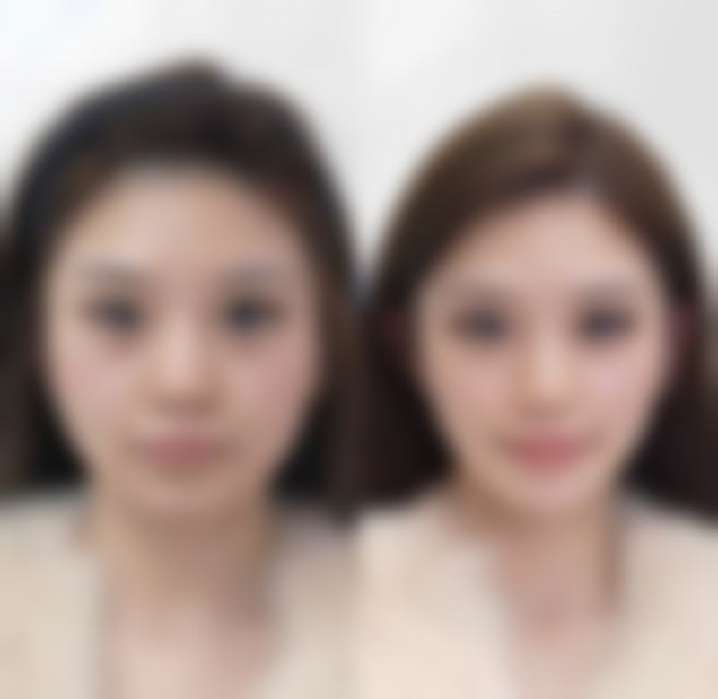 霍然医生技术特点