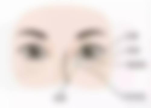 （韩国）崔珍熙医生真实实例