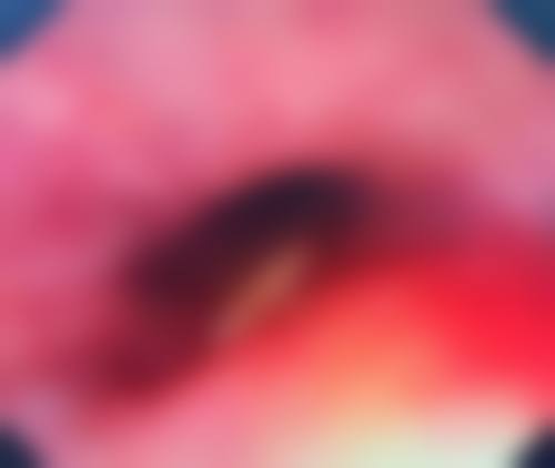 武汉维纳斯医疗整形医院口碑怎么样