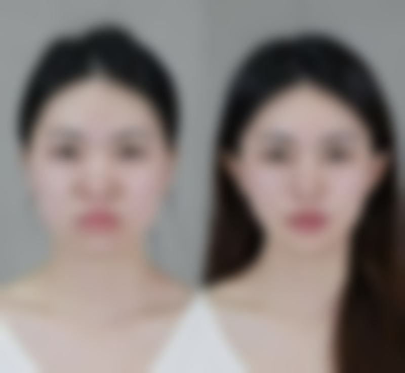 平顶山星美医疗美容门诊部真实实例